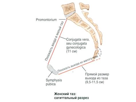 Таз в целом