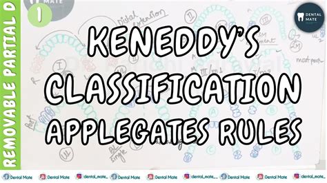 Kennedys Classification Applegates Rules Removable Partial Denture Dr Paridhi Agrawal