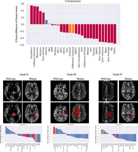 Comparisons Of Idh Wild Type And Idh Mutant Gliomas Within Who Grades