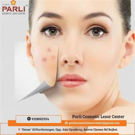 Acne Scar Pimple Treatment Artofit