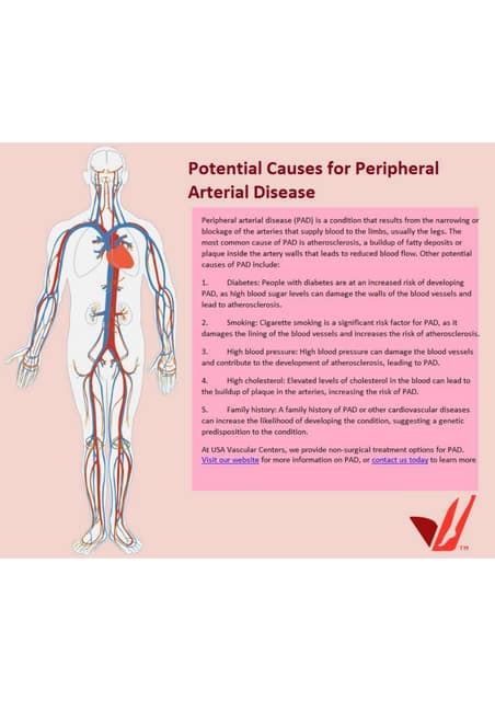 Potential Causes For Peripheral Arterial Diseasepdf