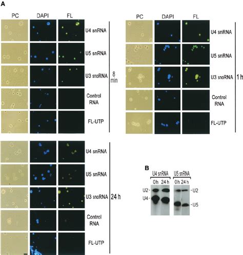 Nucleolar localization of U4 and U5 snRNA. (a) Fluorescein-labeled U4 ... 