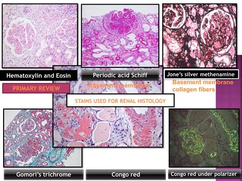 Interpretation of Renal Biopsy | PPTX