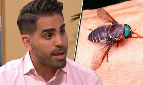 Horsefly bite: Signs of insect bite revealed by This Morning Dr Ranj ...