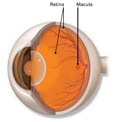 Macular Degeneration - Macula Retina Vitreous Center