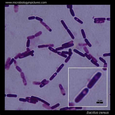 Bacillus Cereus Alchetron The Free Social Encyclopedia