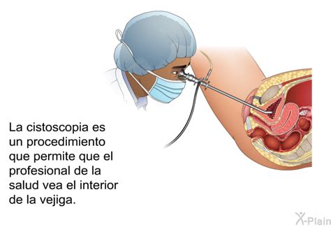 PatEdu La Cistoscopia Mujeres