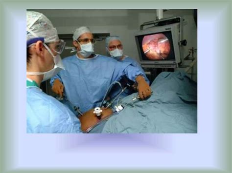 Ergonomics In Laparoscopic Surgery Ppt