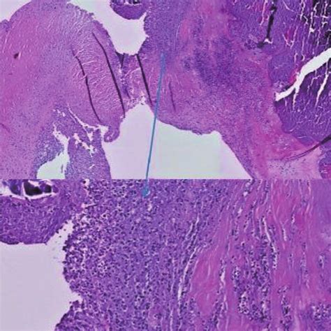 Histology of the native aortic valve (hematoxylin and eosin, ×20 and ...