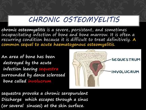 Ppt Chronic Osteomyelitis Powerpoint Presentation Free Download Id