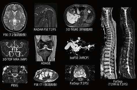 Mri T Mri Echelon Smart Plus