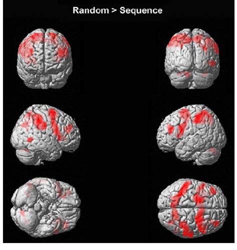 Activation Related To Visuo Motor Task Performance Unconfounded With