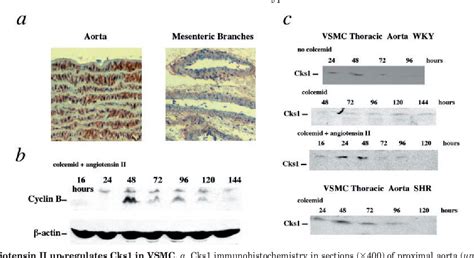 positive regulation of vascular smooth muscle cell differentiation ...