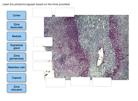 Label The Photomicrograph Based On The Hints Provided Solved Lab 11