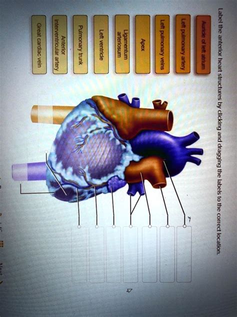 SOLVED: Great cardiac vein, interventricular artery, Anterior ...