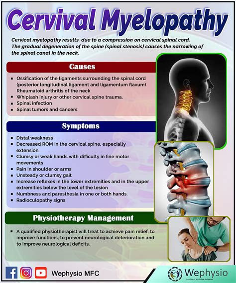 Cervical myelopathy