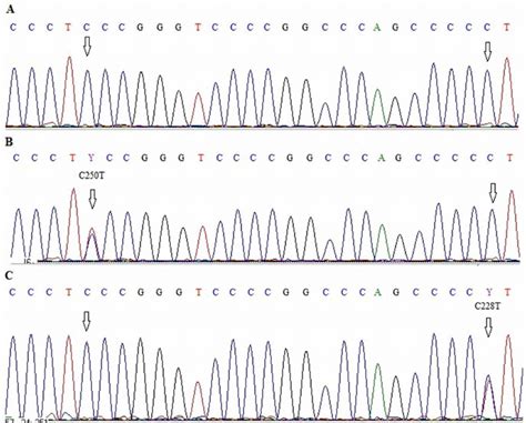 Electropherograms Showing Sequence Of Tert Promoter Region With Two