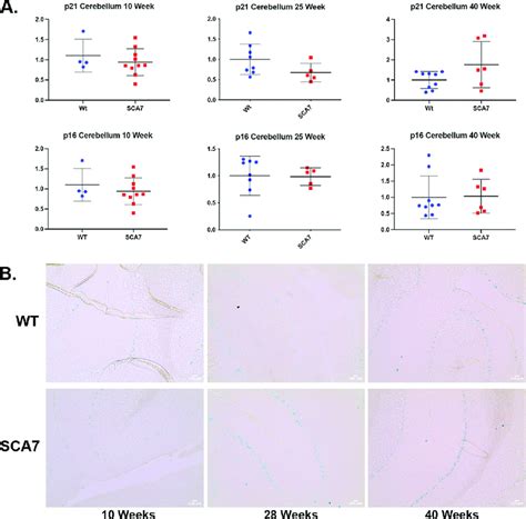 Sca7 140q 5q Cerebellum Demonstrates Sa ßgal Positive Staining Without Download Scientific