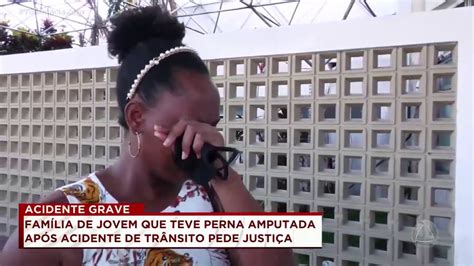 Família de jovem que teve perna amputada em acidente pede justiça