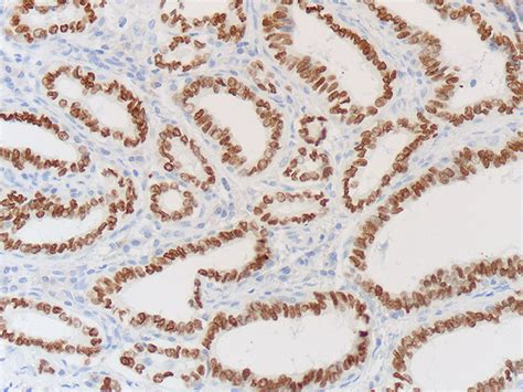 Thyroid Transcription Factor TTF 1 Histology Slides