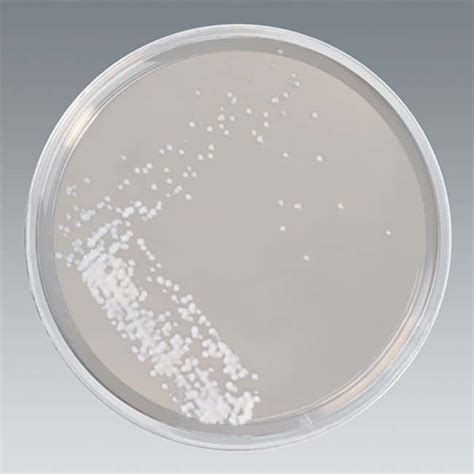 Thermo Scientific™ Sabouraud Dextrose Agar | Fisher Scientific