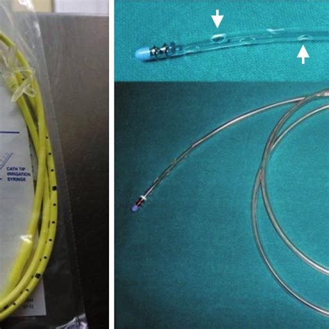 PDF Chapter 41 Nasojejunal Tube Placement