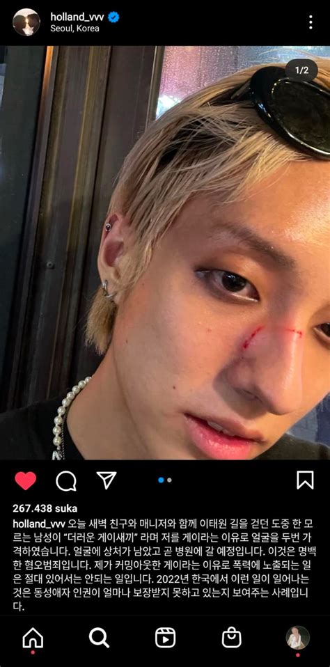 Becoming The First Gay Idol Holland S Journey As A Singer In South Korea Was Not Easy Once