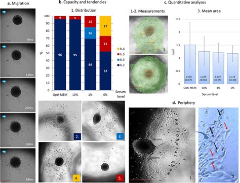 Sw71 Spheroids Propensity For Migration A Time Lapse Imaging Of Download Scientific Diagram