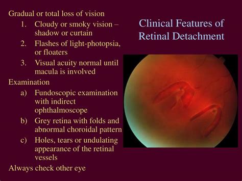 Ppt Acute Vision Loss Powerpoint Presentation Free Download Id 3000924