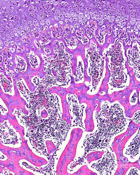 Endochondral Ossification Photograph By Jose Calvo Science Photo