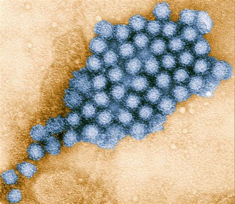 Norovirus gives 699 million people diarrhea every year. No one talks