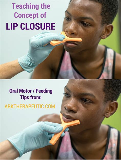 Oral Motor Exercises To Improve Lip Closure – Online degrees