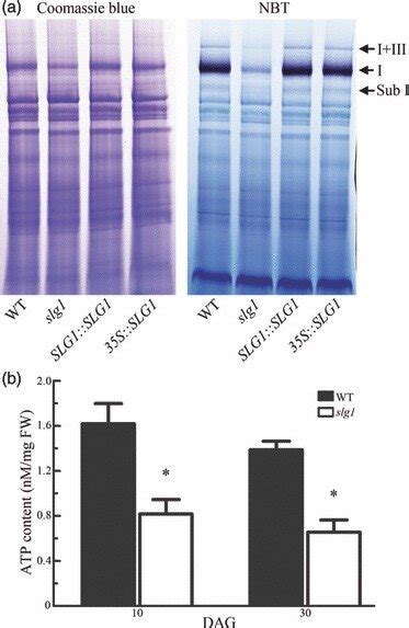 The NADH dehydrogenase activity of complex I and ATP production in the... | Download Scientific ...