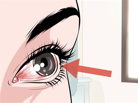 How to Choose Contact Lenses: 15 Steps (with Pictures) - wikiHow
