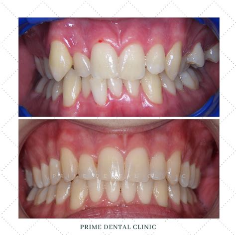 Ortodontia Prime Dental Clinic