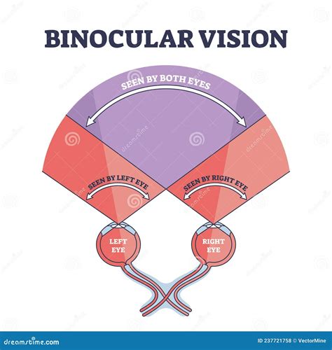 Binocular Vision Disorders With All Eye Defect Examples Outline Diagram ...