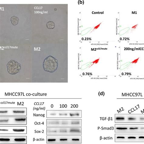 Ccl Expression In Hcc Tissues And Its Association With Patients