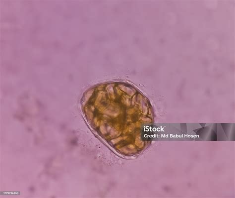 Giardia Lamblia Cysts And Trophozoite Form Muscle Fiber In Stool Examination Under 40x Light