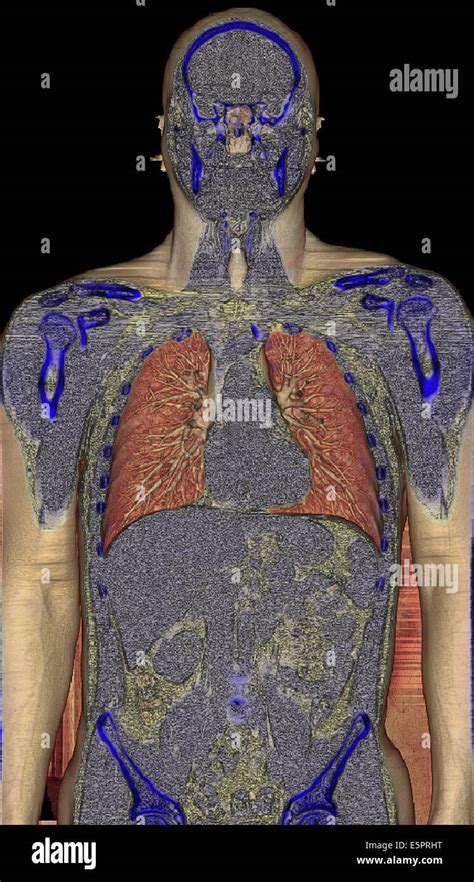 3D tomografía axial computarizada TAC la reconstrucción cara sección