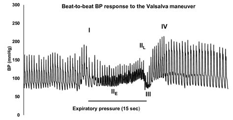 Beat-to-beat blood pressure (BP) response during the Valsalva maneuver