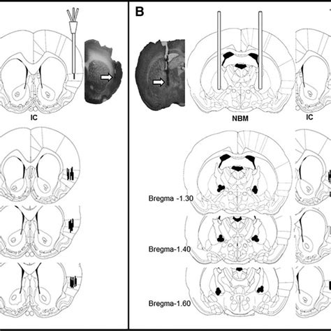 Coronal section diagrams and representative photomicrographs of ... 