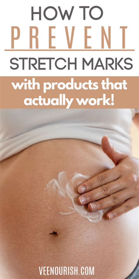 How To Prevent Stretch Marks During Pregnancy With Products That Work