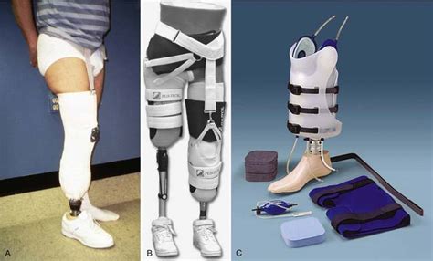 Rehabilitation And Prosthetic Restoration In Lower Limb Amputation Musculoskeletal Key