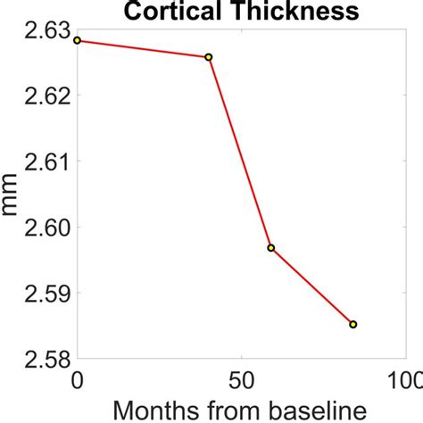 Contrasting Longitudinal Trajectories Associated With Aβ Accumulation