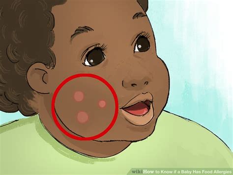 How to Know if a Baby Has Food Allergies (with Pictures) - wikiHow