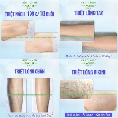 Triệt Lông Bikini Vùng Kín Giá Bao Nhiêu 99k buổi 2024
