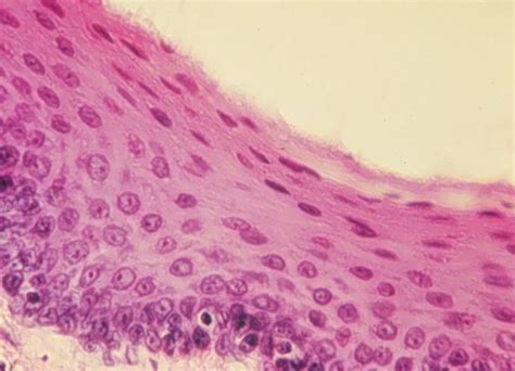 Basic Tissues Epithelium And Connective Tissues Flashcards Quizlet