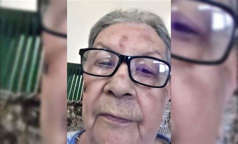 Anciana Cubana Necesita Con Urgencia Un Marcapasos Desabastecido En La