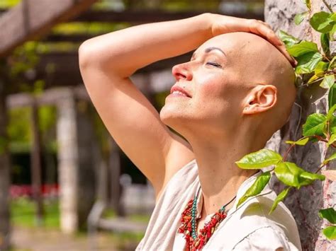 Alopecia areata universal Síntomas causas y tratamiento CIO Salud