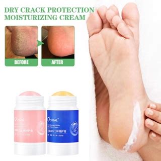 O CHEAL Anti Drying Crack Hand Foot Cream Special Care Care Foot Cream